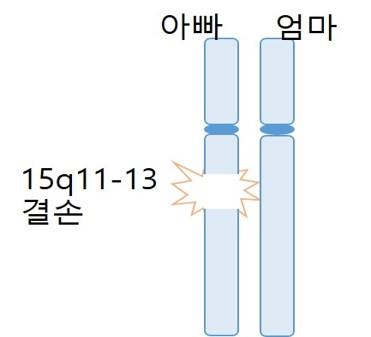 15q11-13결손 그림