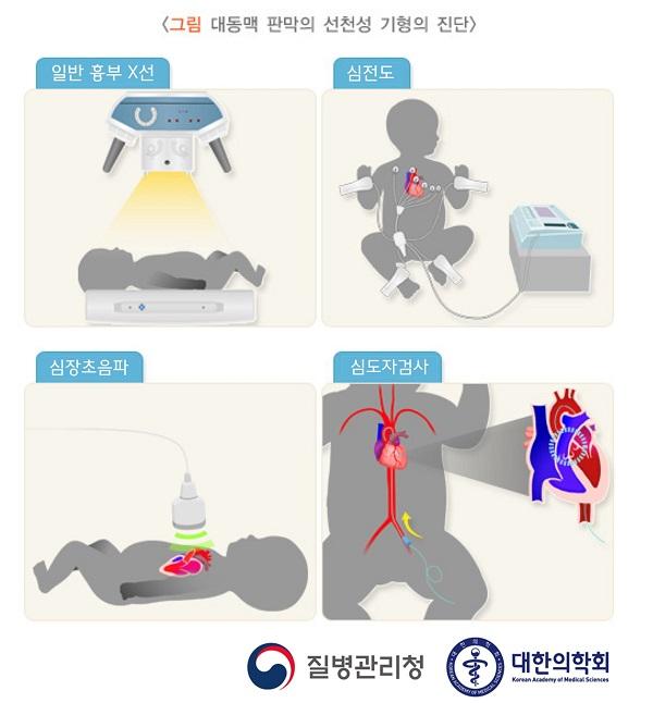 대동맥 판막의 선천성 기형의 진단 그림: 일반 흉부 X선, 심전도, 심장초음파, 심도자검사