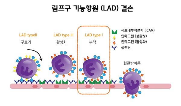 림프구 기능항원(LAD) 결손 그림-LAD typeII 구르기,LAD typeIII 활성화 LAD typeI 부착, 혈관밖이동