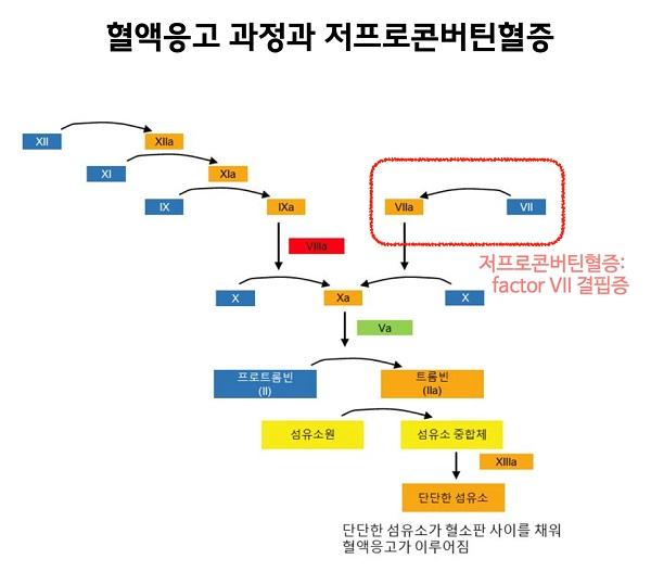 현액응고 과정과 저프로콘버틴혈증 그림-저프로콘버틴혈증:factor VII결핍증, 단단한 섬유소가 혈소판 사이를 채워 혈액응고가 이루어짐