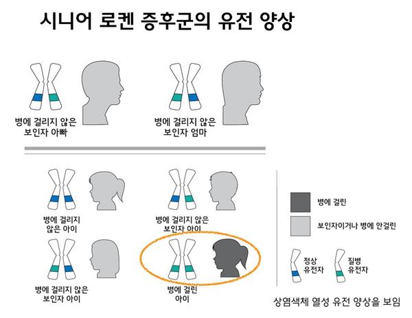 시니어 로켄 증후군의 유전 양상 그림