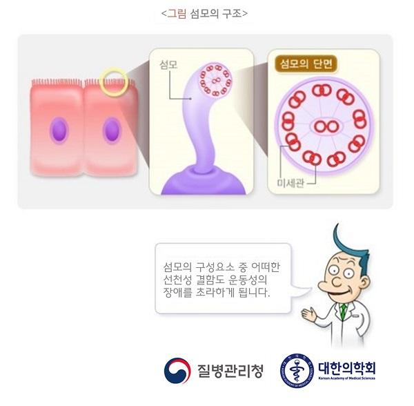 섬모의 구조 그림-섬모의 구성요소중 어떠한 선천적 결함도 운동성의 장애를 초래하게 됩니다.