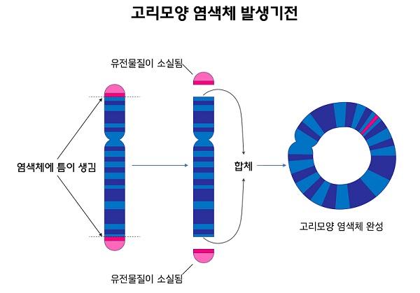 고리모양 염색체 발생기전 그림-엄색체에 틈이 생김-유전물질이 소실됨-합체-고리모양 염색체 완성
