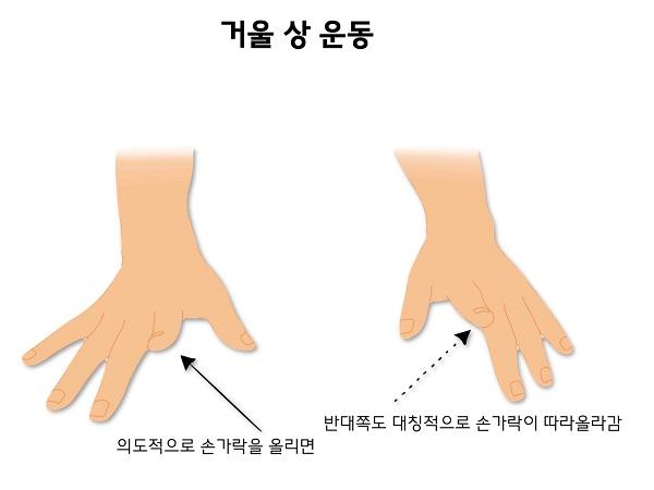 거울 상 운동 그림-의도적으로 손가락을 올리면 반대쪽도 대칭적으로 손가락이 따라올라감