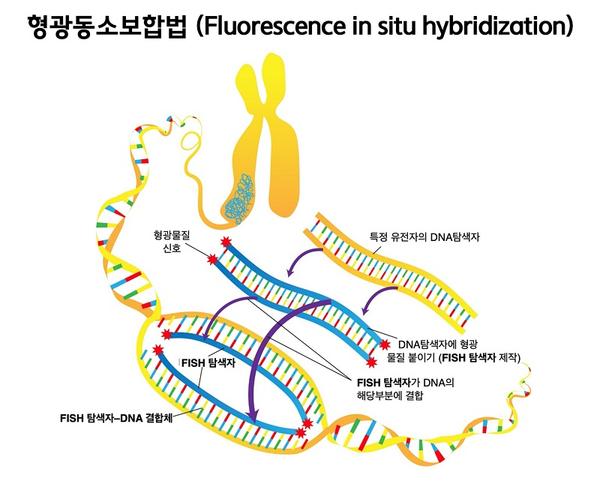 형광동소보합법 (Fluorescenece in situ hybridization) 그림. 1.특정 유전자의 DNA탐색자에 형광 물질 붙이기(FISh탐색자 제작). 2.FISh탐색자가 DNA의 해당부분에 결합. 3.FISh탐색자-DNA 결합체.