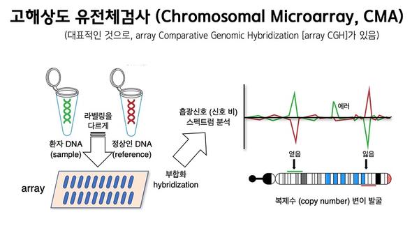 고해상도 유전체검서(Chromosomal Microarray, CMA)-대표적인 것으로,array Comparative Genomic Hybridization [array CGH]가 있음)