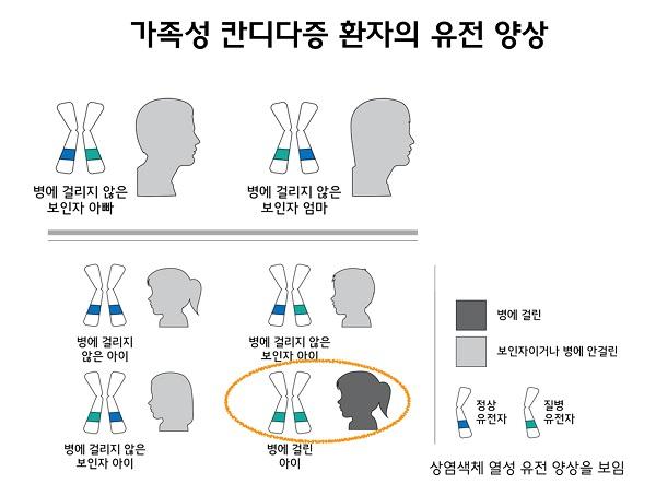 가족성 칸디다증 환자의 유전 양상 그림-상염색체 열성 유전 양상을 보임