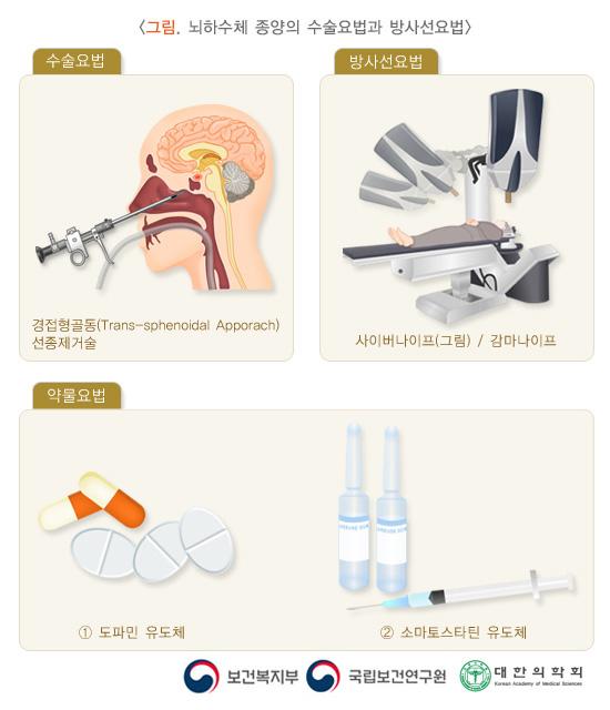 뇌하수체 종양의 수술요법과 방사선요법