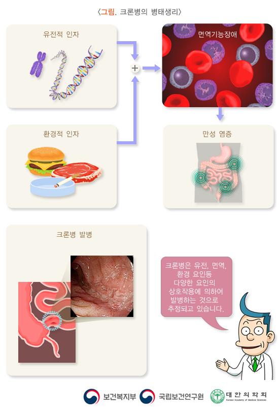 크론병의 병태생리 그림. 유전적 인자+환경적 인자 > 면역기능장애> 만성 염증. 크론병 발병. 크론병은 유전, 면역, 환경 요인등 다양한 요인의 상호작용에 의하여 발병하는 것으로 추정되고 있습니다. 보건복지부, 국립보건연구원, 대한의학회