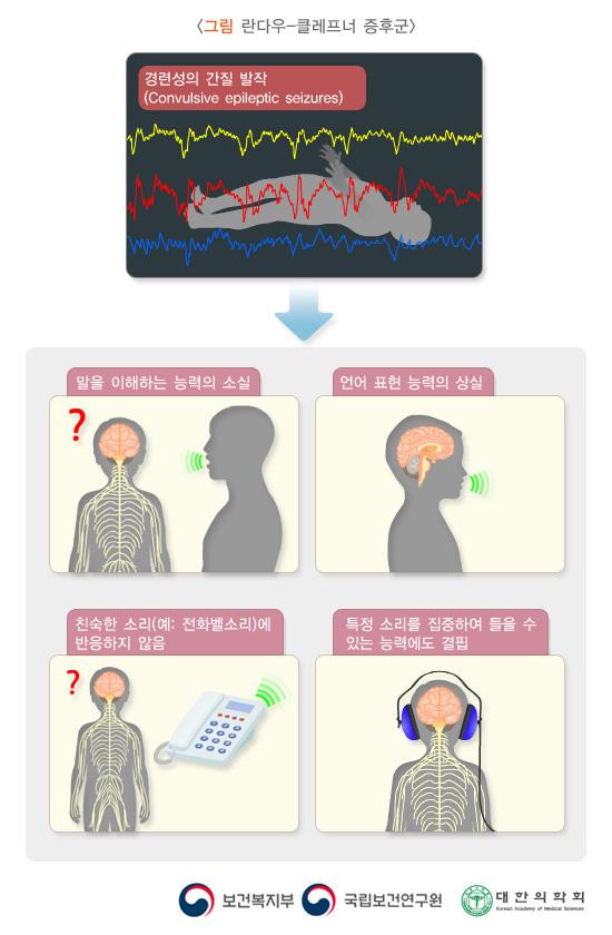 그림 란다우-클레프너 증후군. 경련성의 간질 발작(Convulsive epileptic seizures) > 말을 이해하는 능력의 소실, 언어 표현 능력의 상실, 친숙한 소리(예: 전화벨소리)에 반응하지 않음, 특정 소리를 집중하여 들을 수 있는 능력에도 결핍. 보건복지부, 국립보건연구원, 대한의학회
