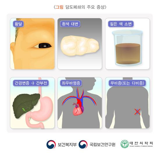 담도폐쇄의 주요 증상