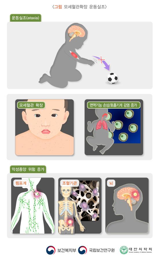 모세혈관확장 운동실조