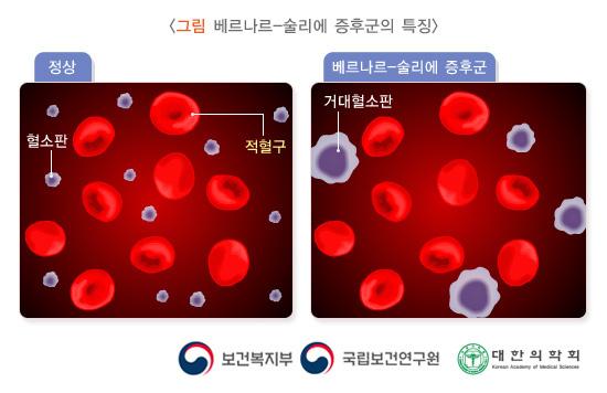 베르나르-술리에 증후군의 특징