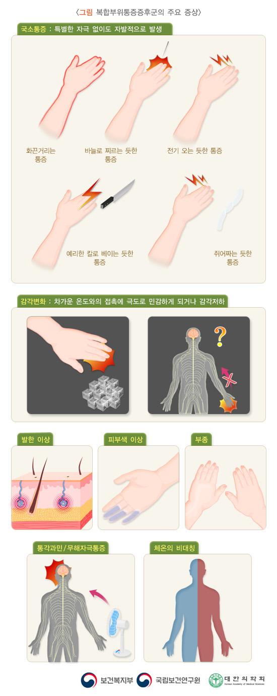 복합부위통증증후군의 주요 증상: 국소통증(특별한 자극 없이도 자발적으로 발생) - 화끈거리는 통증, 바늘로 찌르는 듯한 통증, 전기 오는 듯한 통증, 예리한 칼로 베이는 듯한 통증, 쥐어짜는 듯한 통증과 감각변화(차가운 온도와의 접촉에 극도로 민감하게 되거나 감각저하)와 발한 이상, 피부색 이상, 부종, 통각과민/무해자극통증, 체온의 비대칭. 보건복지부, 국립보건연구원, 대한의학회.