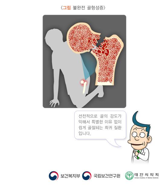 불완전 골형성증