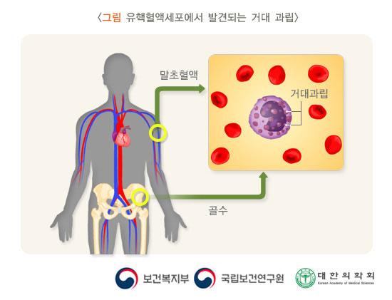 유핵혈액세포에서 발견되는 거대 과립
