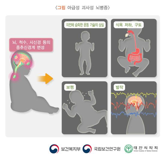 아급성 괴사성 뇌병증