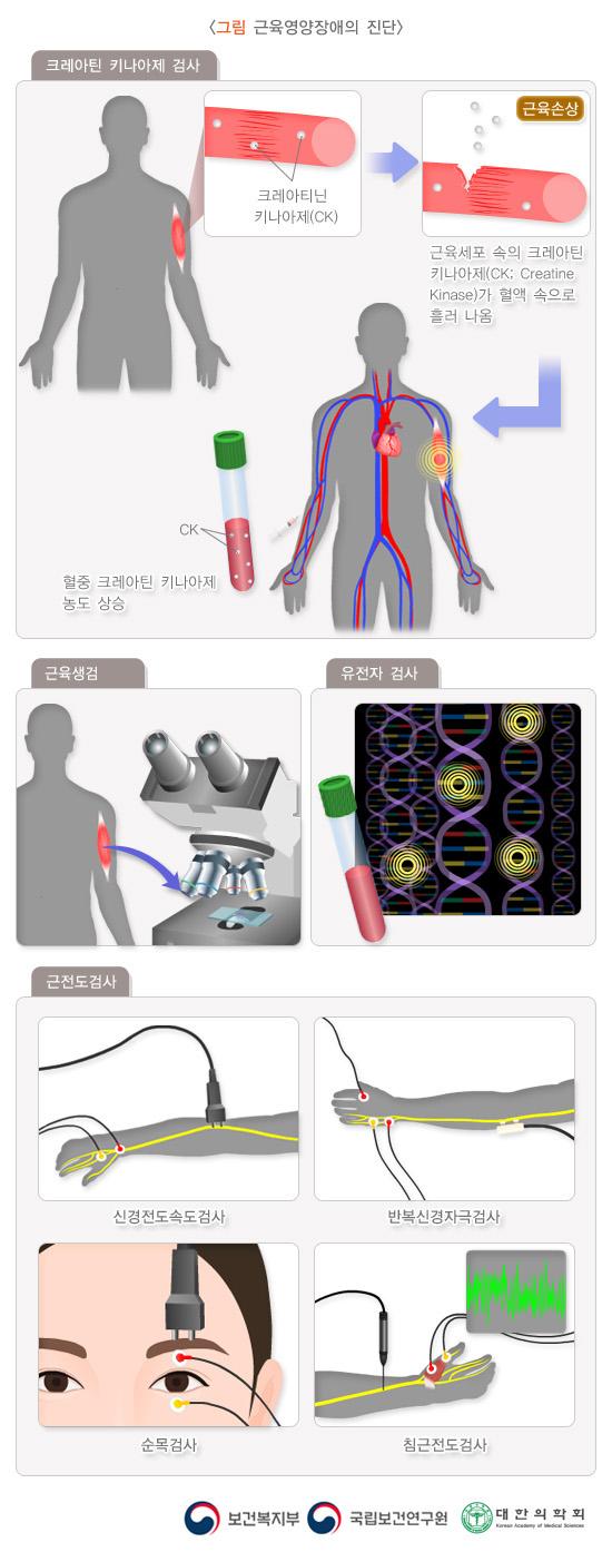 근육영양장애의 진단