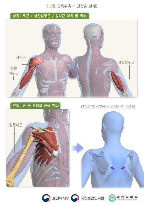 근육영양장애의 진단