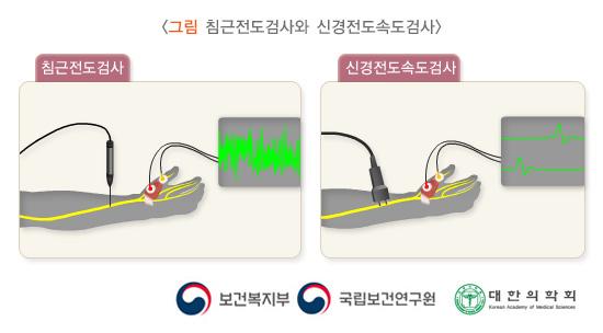 침근전도검사와 신경전도속도검사