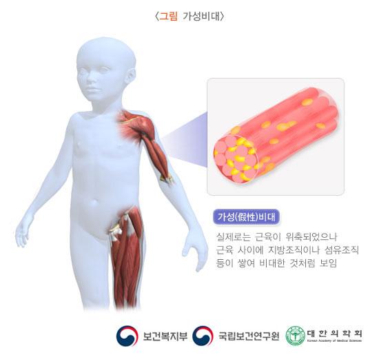 가성비대