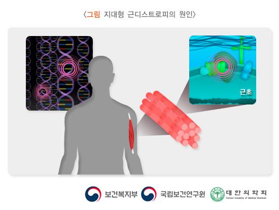 지대형 근디스트로피의 원인