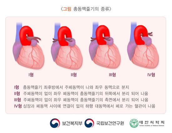 총동맥줄기의 종류