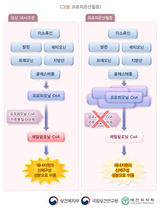 프로피온산혈증