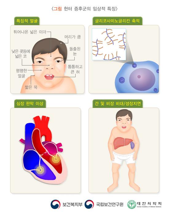  헌터 증후군의 임상적 특징