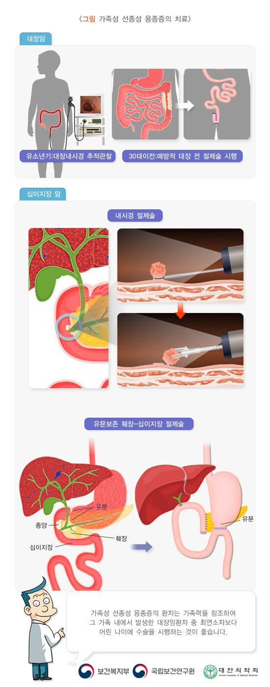 그림 가족성 선종성 용종증의 치료. 대장암. 유소년기: 대장내시경 추적관찰. 30대 이전: 예방적 대장 전 절제술 시행. 십이지장 암. 내시경 절제술. 유문보존 췌장-십이지장 절제술. 유문 이후 종양이 있는 부분을 절제 후 십이지장 뒷부분과 접합. 가족성 선종성 용종증의 환자는 가족력을 참조하여 그 가족 내에서 발생한 대장암환자 중 최연소자보다 어린 나이에 수슬을 시행하는 것이 좋습니다.