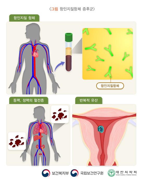 항인지질항체 증후군