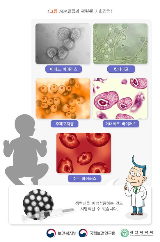 ADA결핍과 관련된 기회감염