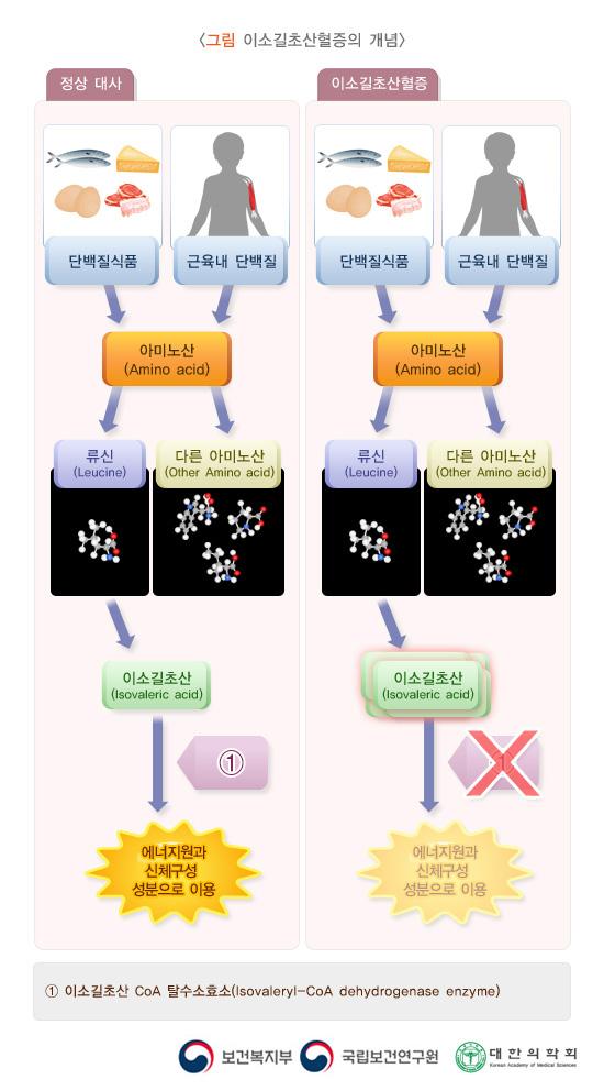 이소길초산혈증의 개념