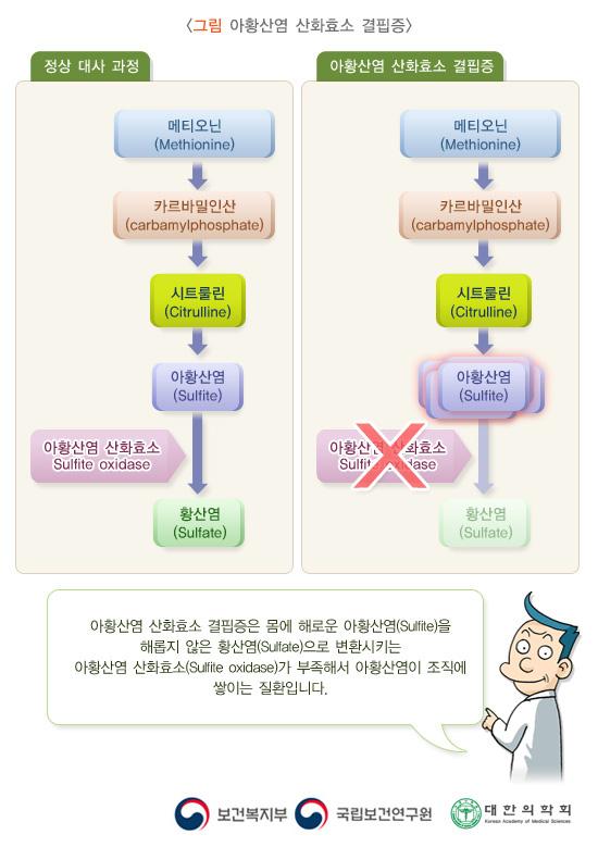 아황산염 산화효소 결핍증