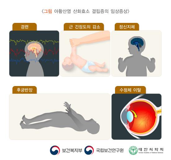 아황산염 산화효소 결핍증의 임상증상