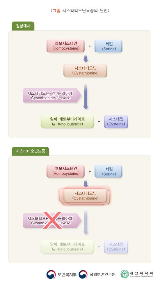 시스타티오닌뇨증의 원인