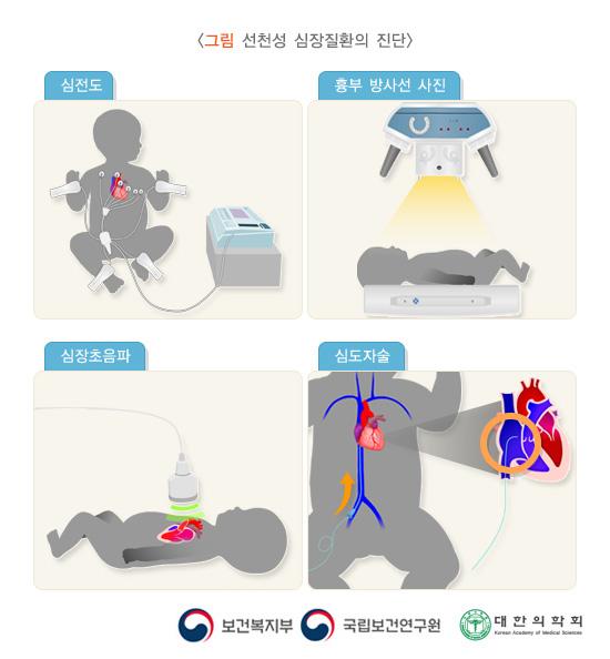 선천성 심장질환의 진단