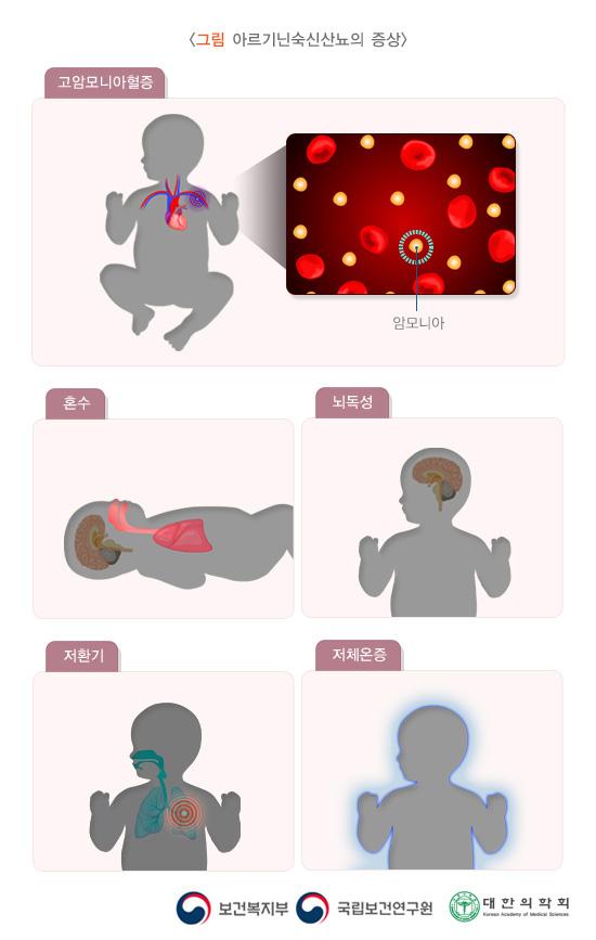 아르기닌숙신산뇨의 증상