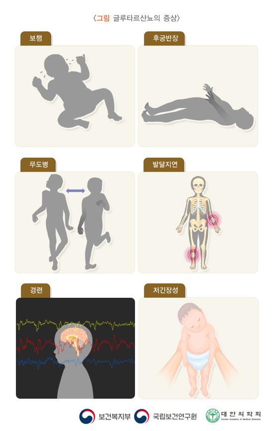 글루타르산뇨의 증상