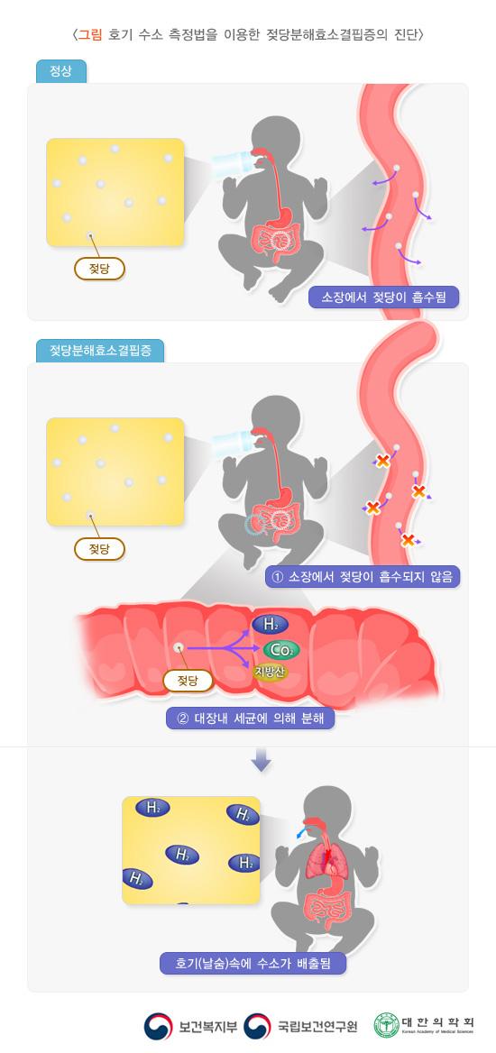 호기 수소 측정법을 이용한 젖당분해효소결핍증의 진단