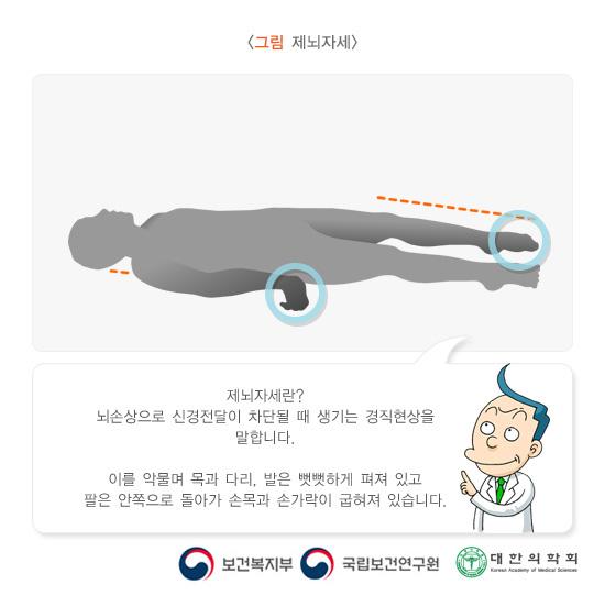 제뇌자세