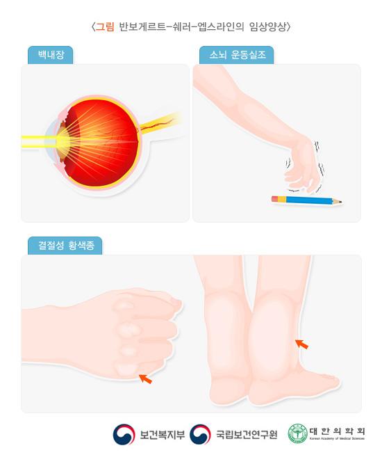 반보게르트-쉐러-엡스라인의 임상양상