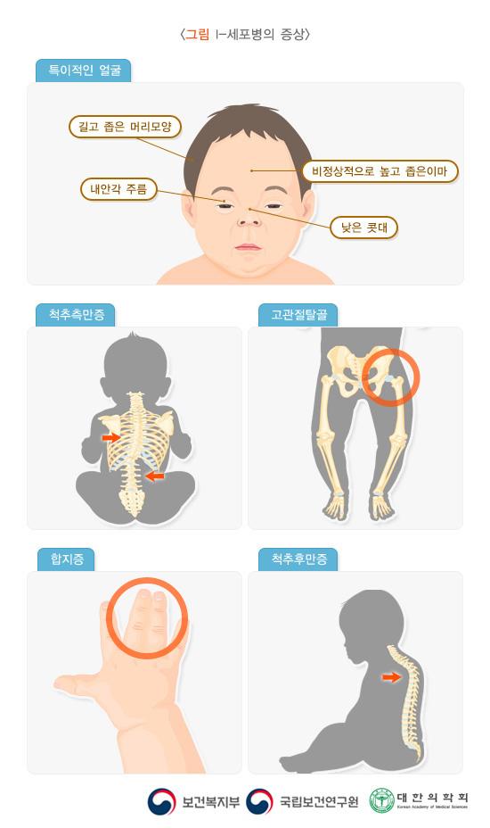 I-세포병의 증상