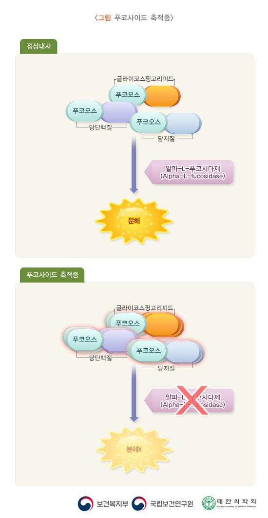 푸코사이드 축적증