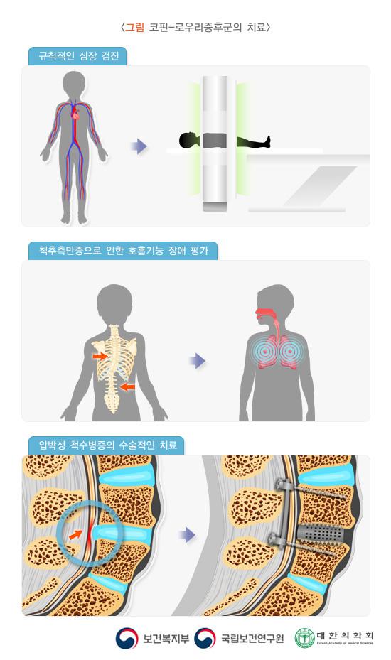 코핀-로우리증후군의 치료: 규칙적인 심장 검진, 척추측만증으로 인한 호흡기능 장애 평가, 압박성 척수병증의 수술적인 치료