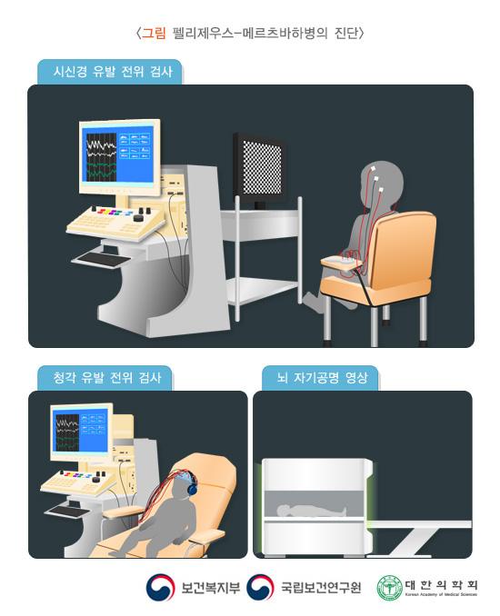펠리제우스-메르츠바하병의 진단