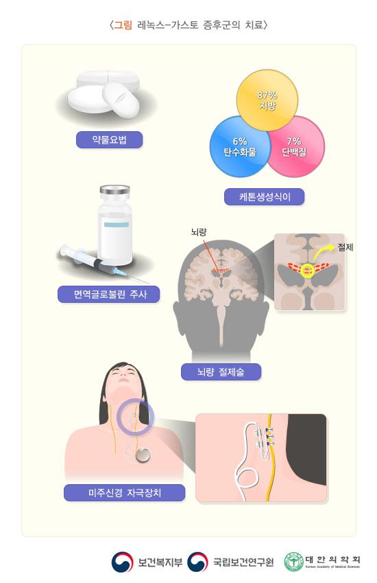 레녹스-가스토 증후군의 치료