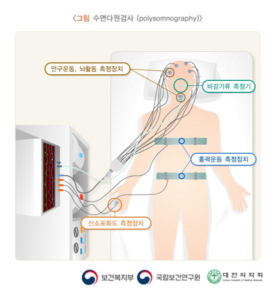 수면다원검사(polysomnography)