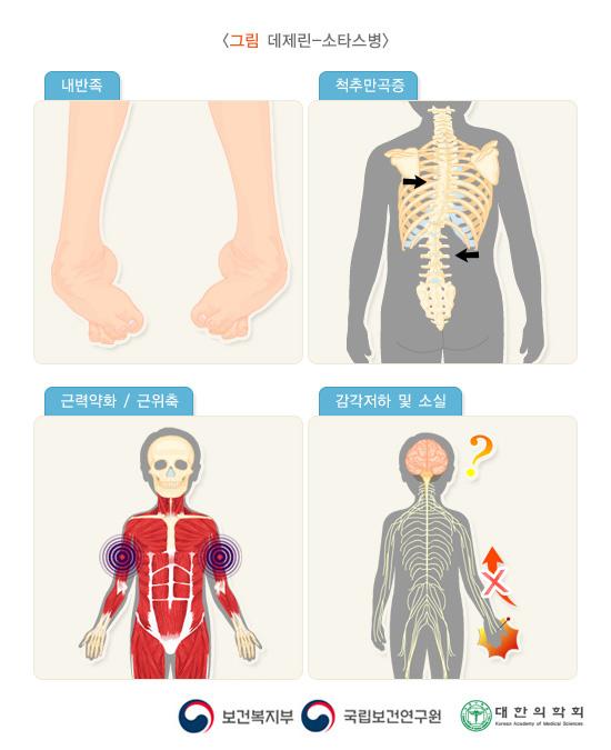 데제린-소타스병