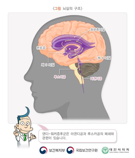 뇌실의 구조